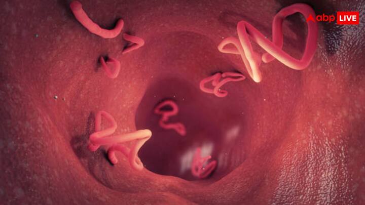पत्तागोभी में टेपवर्म (Tapeworms) पाए जाते हैं, जो सेहत को गंभीर नुकसान पहुंचा सकते हैं. धागेनुमा यह कीड़ा इतना छोटा होता है कि इन्हें देखना काफी मुश्किल होता है.