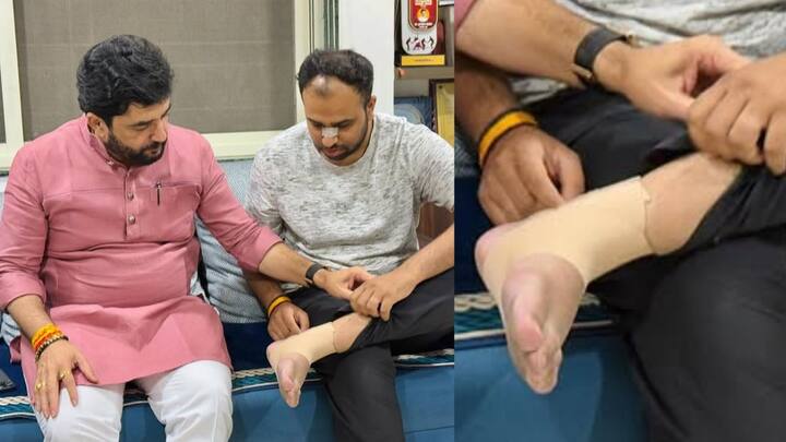 अद्याप एक जण फरार आहे, फरार असलेला गुंड गज्या मारणेचा भाचा असल्याचा माहिती आहे. घटनेमध्ये मारहाण करण्यात आलेला तरुण देवेंद्र जोग भाजपचा कार्यकर्ता असल्याचे समोर आले आहे.