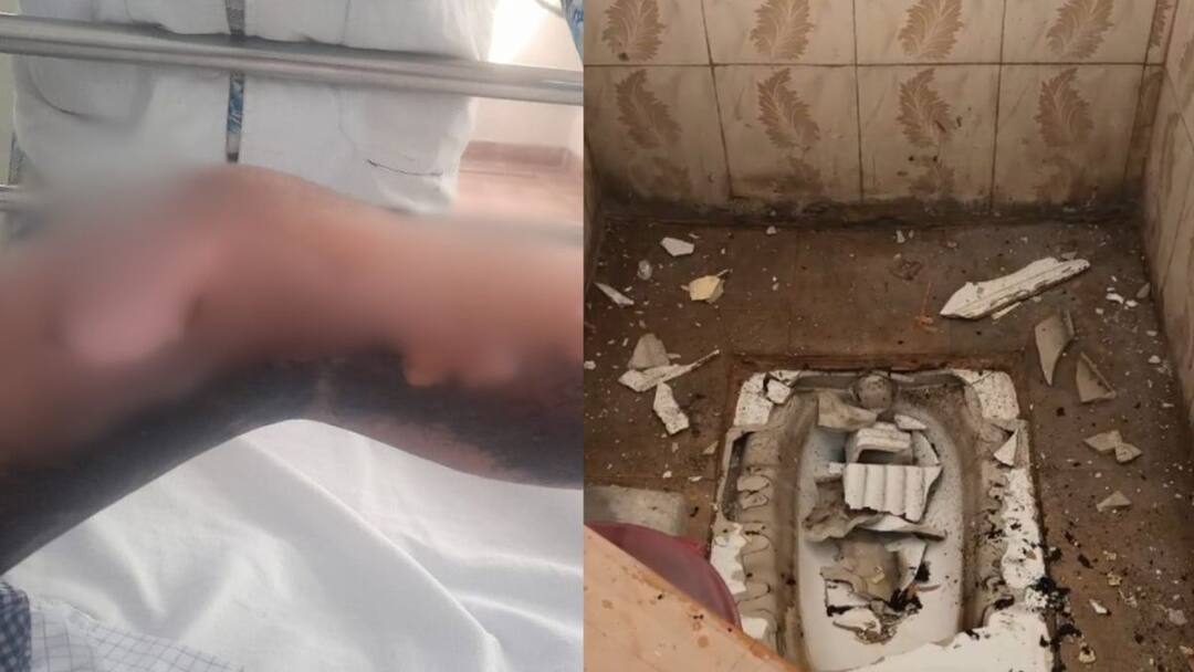 Chhattisgarh School bathroom flush blast sodium fourth class girl injured ANN Chhattisgarh: स्कूल के बाथरूम में फ्लश दबाते ही हुआ ब्लास्ट! चौथी क्लास की छात्रा झुलसी