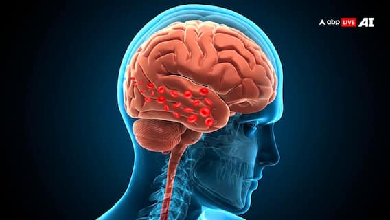 Myths Vs Facts: क्या हाई ब्लड प्रेशर से भी दिमाग में बन सकते हैं खून के थक्के? जान लीजिए सच