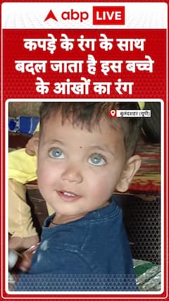 Shocking! This Child’s Eye Color Changes with Clothes | ABP News