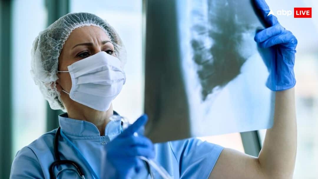 MDR-TB के इलाज के लिए अब नहीं करना होगा डेढ़ साल इंतजार, सिर्फ 6 महीने में ही पूरा हो जाएगा कोर्स MDR TB treatment with B-PaLM regime technique in 6 month only MDR-TB के इलाज के लिए अब नहीं करना होगा डेढ़ साल इंतजार, सिर्फ 6 महीने में ही पूरा हो जाएगा कोर्स