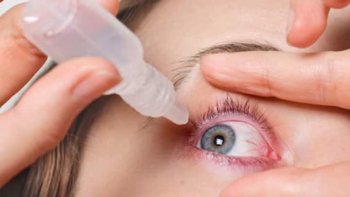 ঋতুবদলের সঙ্গেই রোগভোগ বাসা বাঁধে শরীরে। এই সময় কনজাঙ্কটিভাইটিসে আক্রান্ত হন অনেকেই।