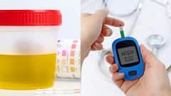Diabetes Urine Symptoms: જો પેશાબમાં આ લક્ષણો જોવા મળે તો થઈ જાવ એલર્ટ, નહીં તો મુશ્કેલીમાં મૂકાશો