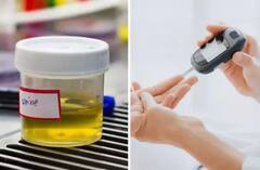 Diabetes Urine Symptoms: જો પેશાબમાં આ લક્ષણો જોવા મળે તો થઈ જાવ એલર્ટ, નહીં તો મુશ્કેલીમાં મૂકાશો