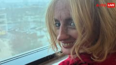 उम्र बढ़ने की रफ्तार 10 गुना ज्यादा! उम्र से पहले बूढ़ी हो रही लड़की, 20 साल की उम्र में सड़ गए दांत, देखें तस्वीरें