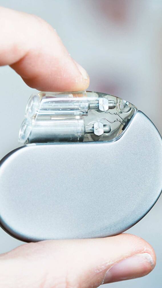 Pacemaker क्या होता है और यह कैसे काम करता है?
