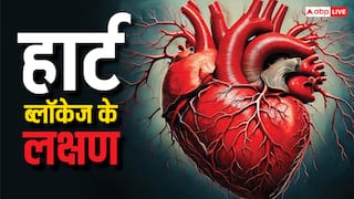 हार्ट में ब्लॉकेज है या नहीं, ये वाला टेस्ट बता देगा सबसे सटीक रिजल्ट