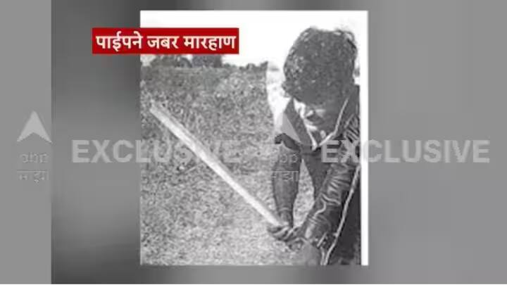 संतोष देशमुखांच्या दंडावर, कोपऱ्यावर, मनगटावर, हाताच्या मुठीवर तसेच मधल्या बोटाला जखमा आहेत. मारहाणीमुळे त्यांचा हात काळा निळा पडलेला होता, असे शवविच्छेदन अहवालात म्हटले आहे.