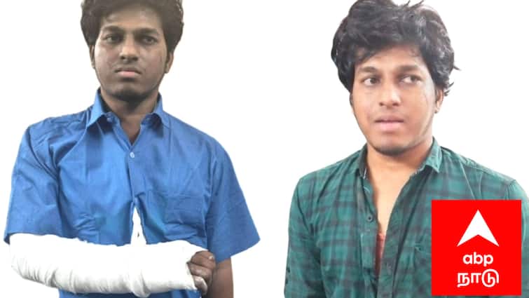 young man who stabbed an elderly couple in Mayiladuthurai slipped and fell and fractured a bone தம்பதியை வெறிக்கொண்டு கத்தியால் குத்திய இளைஞருக்கு மாவுக்கட்டு...