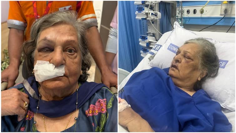 82-Year-Old Woman Falls, Lands In ICU After Air India Denies Wheelchair At Delhi Airport; Airline Responds