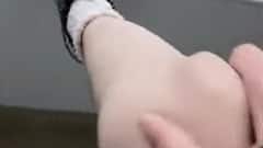 'पेटेला डिस्लोकेशन' के साथ पैदा हुई लड़की, जब चाहे घुटने के कटोरों को निकाल लेती है बाहर!