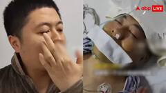 नाक खुजला रहा था शख्स, अचानक फटी धमनी और फिर..मामला जान कांप जाएगा कलेजा