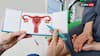 Puberty To Menopause: A Gynaecologist’s Guide To Screenings, Hormones, And Preventive Care