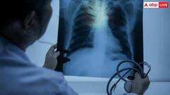 Lung Cancer Symptoms: सिर्फ खांसी ही नहीं हाथ-पैर पर भी दिखाई देते हैं इस कैंसर के लक्षण, जानें हेल्थ एक्सपर्ट की राय?