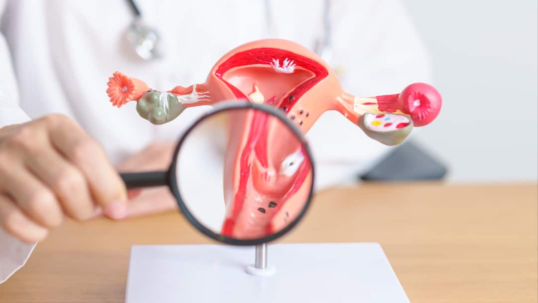 Critical Intersection Of Women's Health And Bleeding Disorders Critical Intersection Of Women's Health And Bleeding Disorders