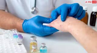 ਸਰੀਰ ਤੋਂ ਪਸੀਨੇ ਦੀ ਥਾਂ ਨਿਕਲਦਾ ਖੂਨ, ਹੋ ਸਕਦੀ ਆਹ ਖੌਫਨਾਕ ਬਿਮਾਰੀ