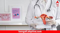 রাগবি বলের মত বড় টিউমর বেরোল মহিলার পেট থেকে ! অবাক সার্জেনরাও