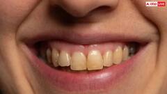 पीले दातों के कारण सबसे सामने होना पड़ता है शर्मिंदा, तो इन घरेलू उपायों से ऐसे चमकाएं