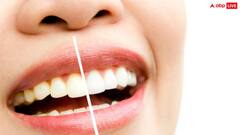 पीले दातों के कारण सबसे सामने होना पड़ता है शर्मिंदा, तो इन घरेलू उपायों से ऐसे चमकाएं