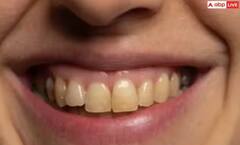 ਪੀਲੇ ਦੰਦਾਂ ਕਰਕੇ ਸਭ ਦੇ ਸਾਹਮਣੇ ਹੁੰਦੀ ਸ਼ਰਮਿੰਦਗੀ ਤਾਂ ਇਨ੍ਹਾਂ ਘਰੇਲੂ ਤਰੀਕਿਆਂ ਨਾਲ ਕਰੋ ਚਿੱਟੇ