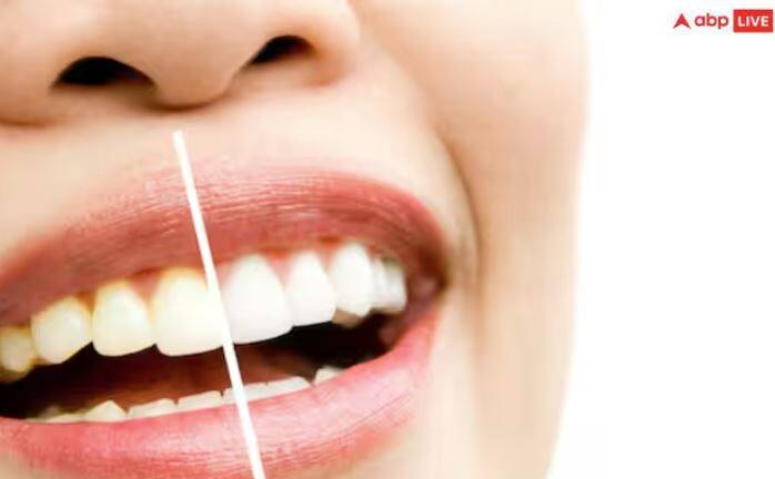 ਨਮਕ ਤੇ ਸਰ੍ਹੋਂ ਦਾ ਤੇਲ: ਜੇ ਤੁਸੀਂ ਆਪਣੇ ਦੰਦਾਂ ਨੂੰ ਚਿੱਟੇ ਅਤੇ ਚਮਕਦਾਰ ਬਣਾਉਣਾ ਚਾਹੁੰਦੇ ਹੋ, ਤਾਂ ਤੁਹਾਨੂੰ ਨਮਕ ਅਤੇ ਸਰ੍ਹੋਂ ਦੇ ਤੇਲ ਦੀ ਵਰਤੋਂ ਕਰਨੀ ਚਾਹੀਦੀ ਹੈ। ਇਸ ਦੇ ਲਈ ਤੁਹਾਨੂੰ ਸਰ੍ਹੋਂ ਦੇ ਤੇਲ ਵਿੱਚ ਇੱਕ ਚੁਟਕੀ ਭਰ ਨਮਕ ਮਿਲਾਉਣਾ ਹੋਵੇਗਾ।