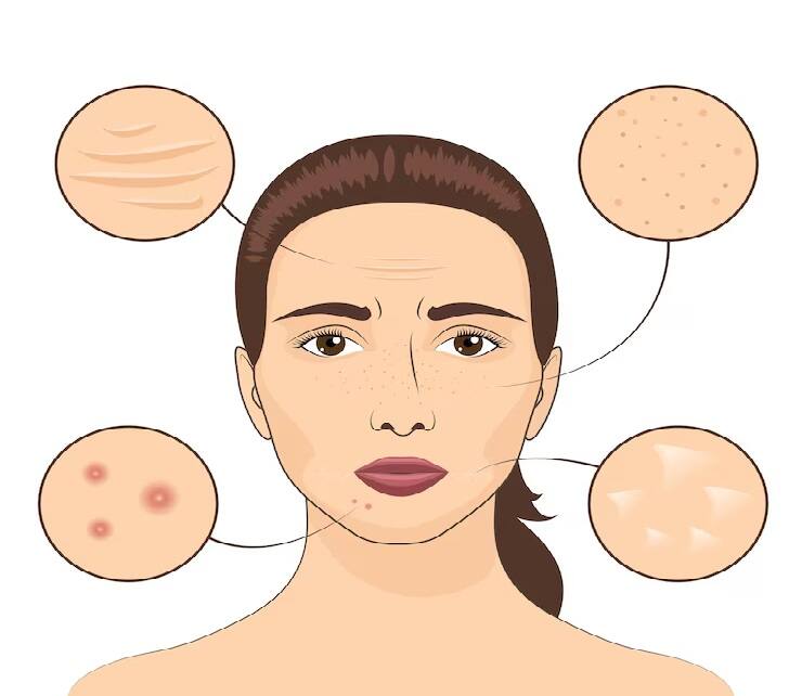 Your skin is sagging prematurely, this remedy will naturally boost collagen Beauty Care Tips: અકાળે જ આપની સ્કિન ઢીલી થઇ રહી છે, આ ઉપાય નેચરલી કોલેજનને કરશે બૂસ્ટ