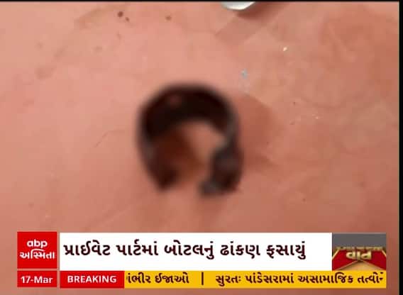 Godhara News : 72 વર્ષના વૃદ્ધના પ્રાઇવેટ પાર્ટમાં ફયાયું ઢાંકણું, ભારે જહેમત બાદ કઢાયું બહાર