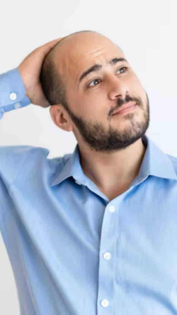 सिर पर नहीं रहे बाल,गंजे सिर से ही शक्स कमाने लगा पैसा,हैरान रह जायेगें आप