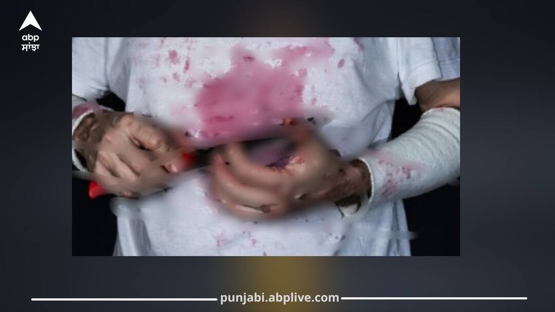 AAP Leader Stabbed in Stomach by Tenant After Asking to Pay Electricity Bill, Undergoing Treatment in Hospital ਬਿਜਲੀ ਦਾ ਬਿੱਲ ਭਰਨ ਲਈ ਕਹਿਣਾ AAP ਨੇਤਾ ਨੂੰ ਪਿਆ ਭਾਰੀ, ਕਿਰਾਏਦਾਰ ਨੇ ਢਿੱਡ 'ਚ ਮਾਰਿਆ ਛੁਰਾ, ਹਸਪਤਾਲ 'ਚ ਜ਼ੇਰੇ ਇਲਾਜ