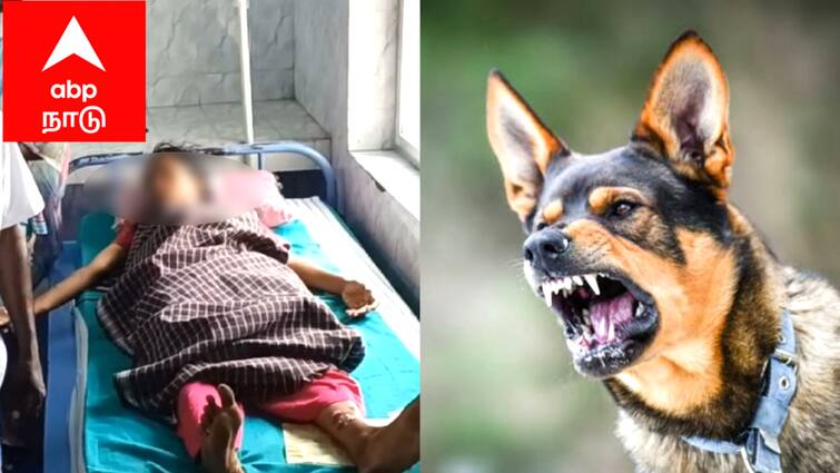 Mayiladuthurai news dog biting 12th class student near sirkazhi tnn 12-ம் வகுப்பு பொதுத்தேர்வு எழுதும் மாணவியை கடித்து குதறிய வெறிநாய் - சீர்காழி அருகே பயங்கரம்