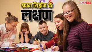World Down Syndrome Day: आखिर क्या बला है डाउन सिंड्रोम, इसमें मरीज को होती हैं क्या-क्या दिक्कतें?