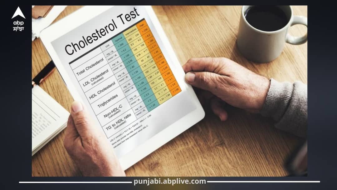 ਪੈਦਲ ਚੱਲਣ 'ਤੇ ਮਿਲਦੇ ਆਹ ਪੰਜ ਸੰਕੇਤ, ਭੁੱਲ ਕੇ ਵੀ ਨਾ ਕਰਿਓ ਇਗਨੋਰ, ਨਹੀਂ ਤਾਂ ਜਾਣਾ ਪੈ ਸਕਦਾ ਹਸਪਤਾਲ do-not-ignore-these-five-symptoms-of-high-cholesterol ਪੈਦਲ ਚੱਲਣ 'ਤੇ ਮਿਲਦੇ ਆਹ ਪੰਜ ਸੰਕੇਤ, ਭੁੱਲ ਕੇ ਵੀ ਨਾ ਕਰਿਓ ਇਗਨੋਰ, ਨਹੀਂ ਤਾਂ ਜਾਣਾ ਪੈ ਸਕਦਾ ਹਸਪਤਾਲ