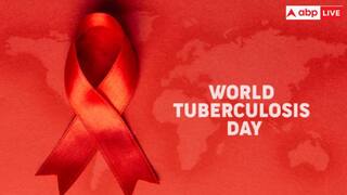 World Tuberculosis Day 2025: कैसे होता है टीबी का इलाज, इसकी वजह से कितना बढ़ता है खतरा?