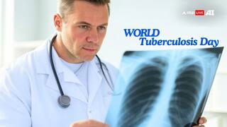 World Tuberculosis Day 2025 — Know Cause, Symptoms, When To See A Doctor, And More