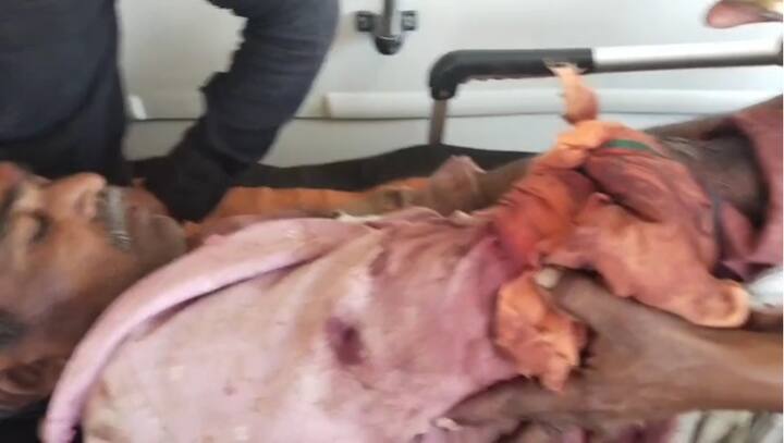 या घटनेमुळे परिसरात एकच खळबळ उडाली असून, शेतकऱ्यांनी हळद शिजवताना सुरक्षिततेच्या दृष्टीने योग्य ती काळजी घेण्याची गरज आहे.