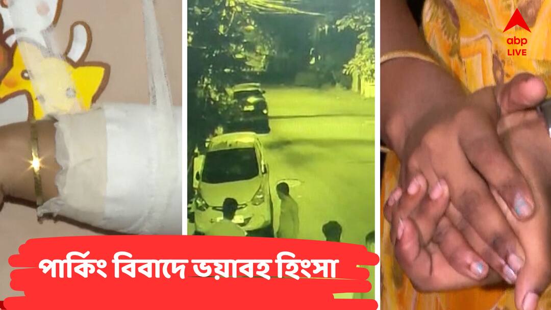Kolkata News : কখনও বেধড়ক মার, কখনও রক্তারক্তি, কখনও খুন!পার্কিং-বিবাদের একের পর এক ভয়াবহ পরিণতি শহরে Kolkata Car Parking Dispute TMC Worker Allegedly Attacks Woman Same Types Of Incidents In The City Kolkata News : কখনও বেধড়ক মার, কখনও রক্তারক্তি, কখনও খুন!পার্কিং-বিবাদের একের পর এক ভয়াবহ পরিণতি শহরে