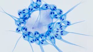 Animal Who Can Survive Oxygen: નો હોય! ઓક્સિજન વિના પણ જીવી શકે છે આ જીવ