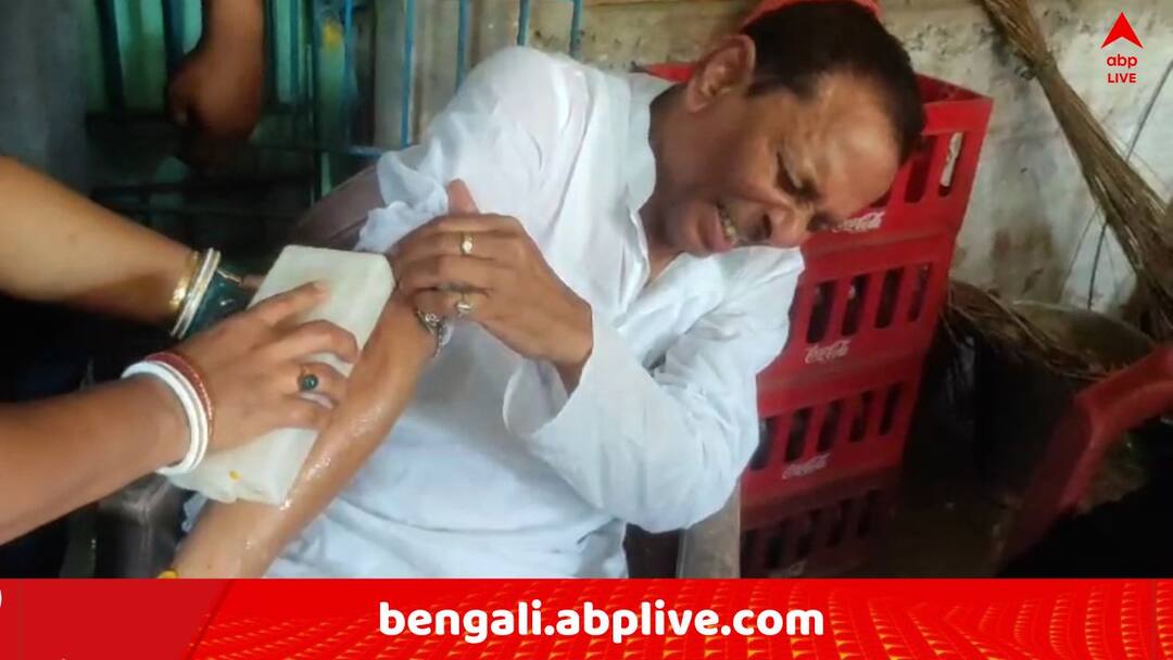 Contai Co-operative Election TMC MLA Akhil Giri attacked in Ramnagar Contai Co-operative Election: 'আক্রান্ত' অখিল গিরি, পুলিশের বিরুদ্ধে হামলার অভিযোগ খোদ TMC বিধায়কের !