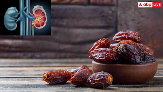 Side Effects Of Eating Dates: किडनी स्टोन से लेकर डायरिया तक, जानें किन लोगों को खजूर खाने से बचना चाहिए?