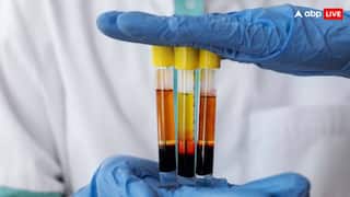 क्या होता है 'मल ट्रांसप्लांट', क्या इससे वाकई बचाई जा सकती है जान