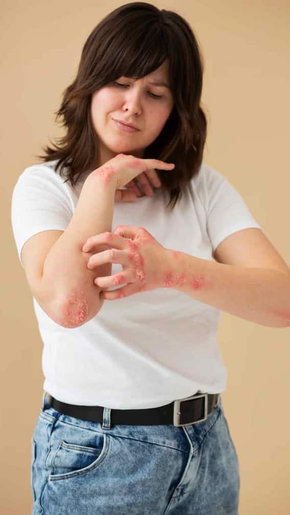 தோல் அரிப்பு மற்றும் சொறிக்கான வீட்டு வைத்தியம் என்ன என்பதை காணலாம்?