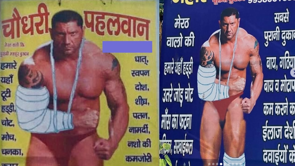 Dave Bautista: Dave Batista treats secretly secret disease and bone in India? Hollywood star revealed himself, share photos
