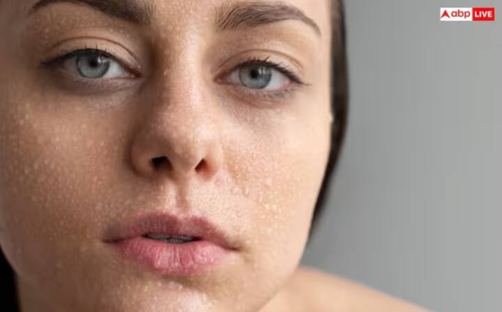 ਸਕਿਨ ਡ੍ਰਾਈ - ਨਿੰਬੂ ਵਿੱਚ ਐਸਿਡ ਹੁੰਦਾ ਹੈ, ਜੋ ਚਮੜੀ ਤੋਂ ਨੈਚੂਰਲ ਤੇਲ ਨੂੰ ਹਟਾ ਸਕਦਾ ਹੈ। ਇਸ ਨਾਲ ਚਮੜੀ ਖੁਸ਼ਕ ਅਤੇ ਪਪੜੀਦਾਰ ਹੋ ਸਕਦੀ ਹੈ।