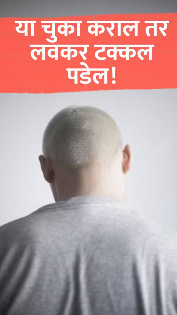 या चुका कराल तर लवकर टक्कल पडेल!