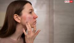 ਫਾਇਦੇ ਹੀ ਨਹੀਂ ਸਕਿਨ ਨੂੰ ਨੁਕਸਾਨ ਵੀ ਪਹੁੰਚਾ ਸਕਦਾ ਨਿੰਬੂ, ਕਿਤੇ ਤੁਸੀਂ ਵੀ ਤਾਂ ਨਹੀਂ ਕਰ ਰਹੇ ਆਹ ਗਲਤੀ