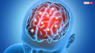 कब फट जाती है इंसान के दिमाग की नस, जानें इसमें जान बचाना क्यों होता है मुश्किल?