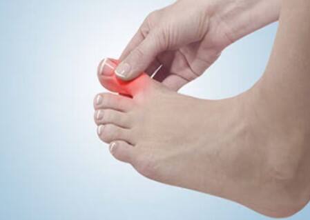 હાઈ-ફ્રુક્ટોઝ કોર્ન સિરપ સાથે બનેલા મીઠા પીણાં યુરિક એસિડનું સ્તર વધારી શકે છે. આનાથી બચવું જોઈએ. તમારા આહારમાં વિટામિન સીથી ભરપૂર ખોરાકનો સમાવેશ કરો, જેમ કે સાઇટ્રસ ફળો, ચેરી, સ્ટ્રોબેરી અને કાકડીઓ, જે યુરિક એસિડના સ્તરને ઘટાડવામાં મદદ કરી શકે છે.