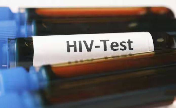 ਇਸ ਤੋਂ ਇਲਾਵਾ, ਜੇਲ ਵਿੱਚ ਐੱਚਆਈਵੀ ਪਾਜ਼ੇਟਿਵ ਮਰੀਜ਼ ਨਾਲ ਅਸੁਰੱਖਿਅਤ ਜਿਨਸੀ ਸੰਬੰਧ ਹੋਣ 'ਤੇ ਵੀ ਐੱਚਆਈਵੀ ਫੈਲਦਾ ਹੈ।