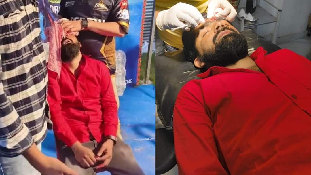 IPL 2025 spectator was injured by Nicholas Pooran shot at Ekana Stadium got 8 stitches ann IPL: इकाना स्टेडियम में निकोलस पूरन की शॉट से घायल हुआ दर्शक, सिर में आए 8 टांके, किसी ने नहीं ली खबर